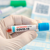 Makedonci tvrde: U Srbiji se prodaju falsifikovani negativni PCR testovi na koronavirus