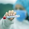 Bečki istraživači razvili novi, povoljniji test na koronavirus