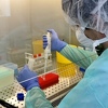 PCR laboratorijama u Zenici i Tešnju nedostaje testova za koronavirus