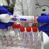 U posljednja 24 sata 130 novozaraženih u RS-u, testirane 663 osobe
