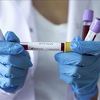 Naučnici u Bernu i Cirihu otkrili kako virus manipulira stanicama da bi se replicirao