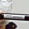 U Republici Srpskoj 74 novozaražene osobe nakon testiranja 579 uzoraka
