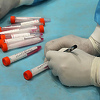 Od ponedjeljka PCR testiranje u RS-u koštat će 105 KM