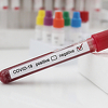 Od sutra za ulazak u SAD obavezan negativan test na koronavirus