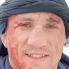 UFC borac završio u bolnici nakon što je greškom skočio glavom na led