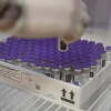 Pfizerove vakcine putem COVAX-a u BiH dolaze do kraja marta, AstraZenecine do kraja maja