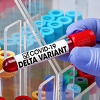 Delta soj koronavirusa potvrđen kod dvoje bh. državljana