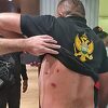 Na Cetinju povrijeđeno najmanje četvero građana, policija ih pogodila suzavcem