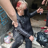 Uhapšena vlasnica rotvajlera koji su jučer brutalno izgrizli ženu u centru Sarajeva