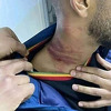 Libijac pokazao jezive posljedice nakon što ga je golman divljački udario tokom utakmice