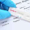 Brzi antigen testovi mogu biti manje precizni u otkrivanju omikron soja koronavirusa