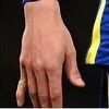 Havertz zadobio jezivu povredu prsta nakon gola, ali nastavio igrati do poluvremena