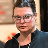 Manekenka viđena u javnosti prvi put nakon što je otkrila da ju je kozmetički tretman deformisao
