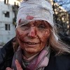 Američki fotoreporter: Moju fotografiju Olene je mučno gledati, ali je ona morala biti snimljena