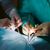 U FBiH sve više pacijenata čeka na transplantaciju, tek rijetki dobiju novu priliku za život