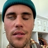 Justin Bieber pokazao da mu je jedna strana lica potpuno paralizirana: Ovo je stvarno ozbiljno
