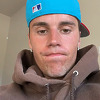 Justin Bieber se oglasio o svom zdravstvenom stanju nakon paralize jedne strane lica