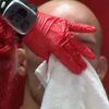 Amerikanac doživio najgori lom nosa u historiji MMA pa želio nastaviti borbu