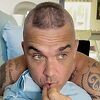 Robbie Williams o gubitku kose: Plaćao sam tretmane po istoj cijeni koliko je kuća moje bake