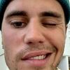 Justin Bieber odgodio svoju svjetsku turneju: Trenutno mi je zdravlje prioritet