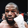 Floyd Mayweather pobijedio youtubera, ali je iz borbe jedino on izašao s masnicom ispod oka