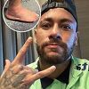 Neymar pokazao nogu nakon povrede protiv Srbije, izgleda još gore nego prije