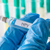 U Sarajevu potrošeno preko 500 HPV vakcina, preostalo još oko 300 doza