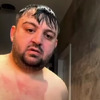 Rumunski vijećnik se pojavio go na online sastanku, njegova kolegica pokušavala suzdržati smijeh