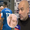 Haaland se skinuo i pokazao ožiljke, Guardiola bijesan zbog onog što mu stoperi rade