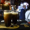 U Velikoj Britaniji gojaznost i konzumacija alkohola sve češći uzrok karcinoma jetre