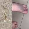 Poskok ugrizao 12-godišnju djevojčicu u Konjević Polju