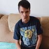 Pomozimo Amelu da otkloni tumor s lica, za operacije mu je potrebno 35.000 eura