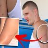 Vidljivi tragovi ožiljaka na rukama Nikole Jokića, poznato odakle oni potječu