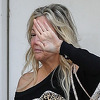 Heather Locklear snimljena u još jednom zabrinjavajućem izdanju, rukom skrivala otečeno lice