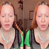 Madonna iznenadila novim snimkom, njeno natečeno lice nije prošlo nezapaženo