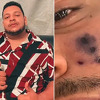 Popularni brazilski pjevač preminuo nakon ugriza pauka: Lice mu je počelo mijenjati boju