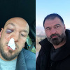 Adnan Redžović uhapšen nakon što je nanio teške tjelesne povrede Iron Pukiju