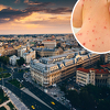Rumunija proglasila epidemiju malih boginja: "Broj zaražene djece je alarmantan"