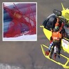 Najbolji skijaš svijeta pao na spustu, helikopterom je prebačen u bolnicu