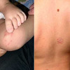 Incident u sarajevskom vrtiću: Majka prijavila policiji da joj je dijete pretučeno