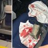 Huligani u Brazilu bacili bombu na autobus s nogometašima, šestero povrijeđenih