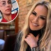 Selma Bajrami javila se iz tuzlanske bolnice i pokazala modrice na oku i ozljedu na usni