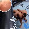 Brazilski borac ugrizao protivnika i završio karijeru u UFC-u nakon samo 8 minuta