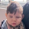Hamza dnevno ima 20 epi napada, ne može govoriti, puzati i sjediti: Pomozimo mu i omogućimo liječenje