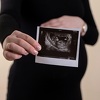 Naučnici uspjeli u rekonstrukciji najranijih faza razvoja ljudskog života