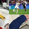 Njemački reprezentativac slomio ruku navijaču, odmah reagovao i savez