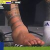 Messijev zglob nakon povrede izgleda potpuno nevjerovatno, šokirao je sve kada je skinuo štucne