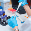 Prvi na svijetu: Nijemac izliječen od virusa HIV transplantacijom matičnih ćelija