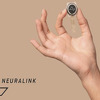 Neuralinkov čip funkcioniše veoma dobro u mozgu drugog pacijenta