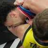 Bryantu "pao mrak na oči", ugrizao je Biberovića tokom derbija Eurolige